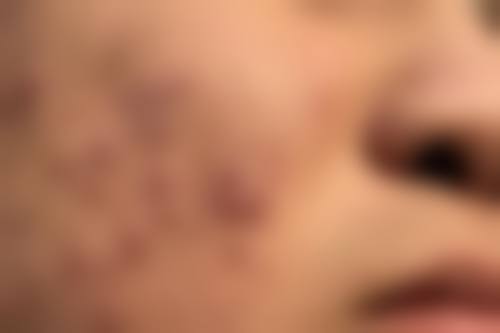 洛阳三叶草医疗美容诊所可靠吗