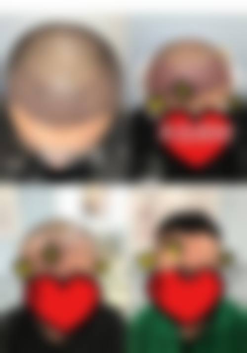 徐州矿务集团总医院整形美容中 心项目特色