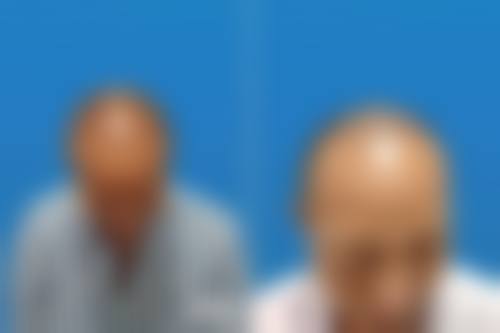 蒋学医生简介口碑如何