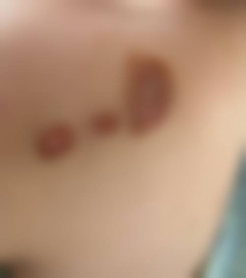 黄晓琴医生简介之项目优势