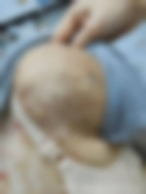 广州美康婕熹卡医疗美容门诊部顾客实例