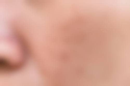 七、武汉凯迪薇娜医疗美容门诊部顾客实例