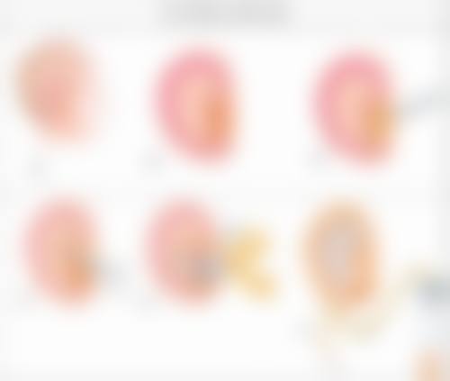 igram整形外科口碑评价如何