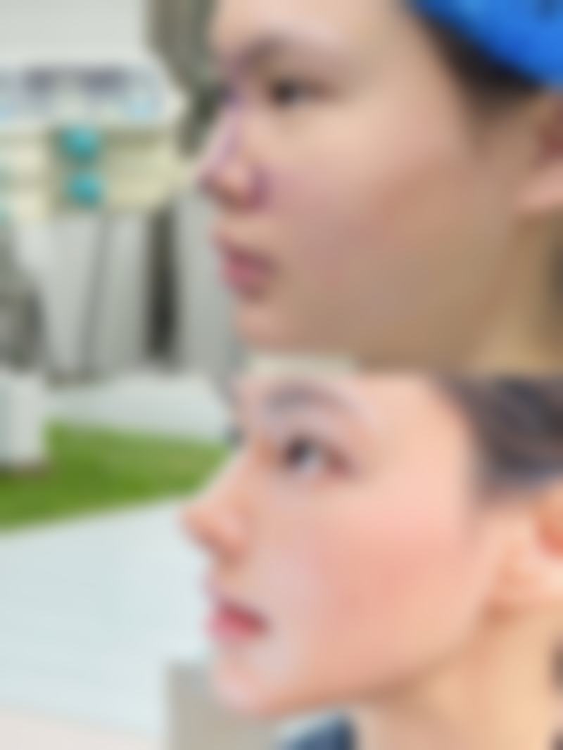 手术疤痕：让“纪念章”悄悄消失