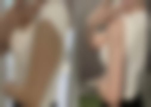 科学祛疤，重拾自信笑容