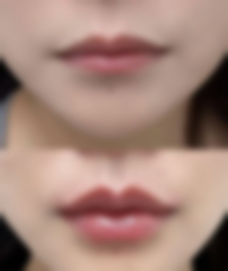 惠州联合丽格整形美容医院项目特色