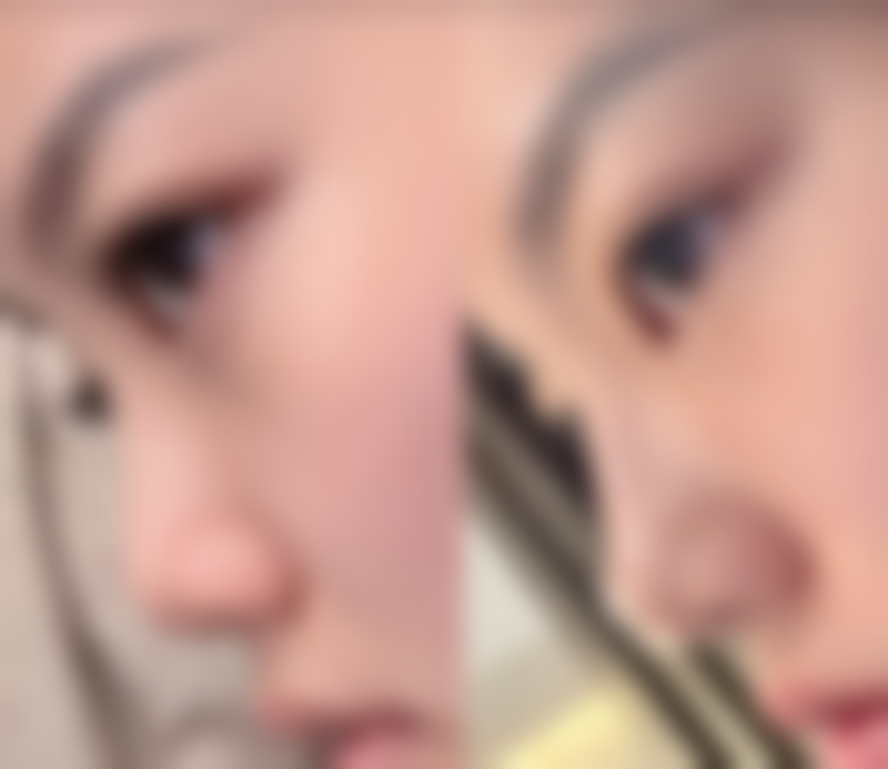 深圳玛楚医疗美容诊所怎么挂号，地址在哪儿