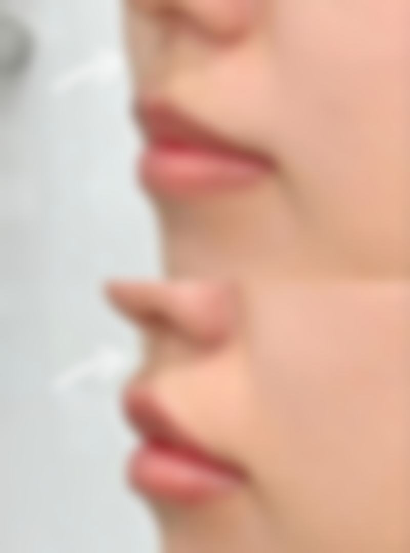 徐炜医生简介之项目优势