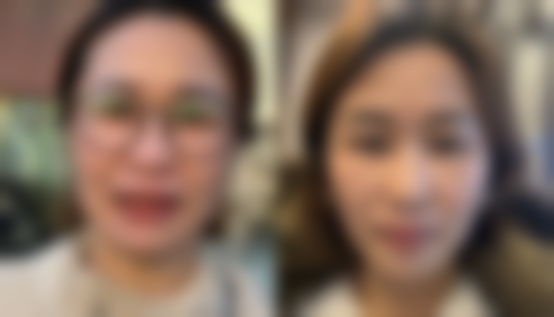 疤痕一直痒：炎症反应惹的祸