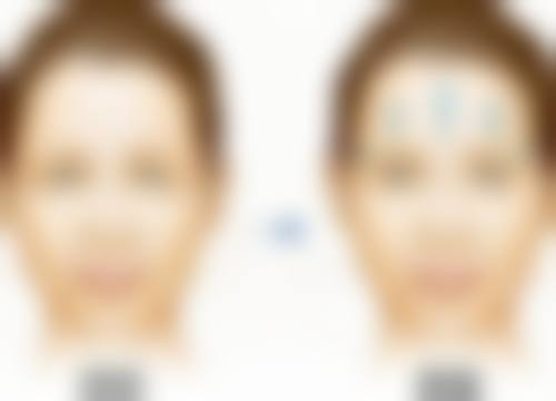 甘肃医学校附属医院烧伤整形科项目特色