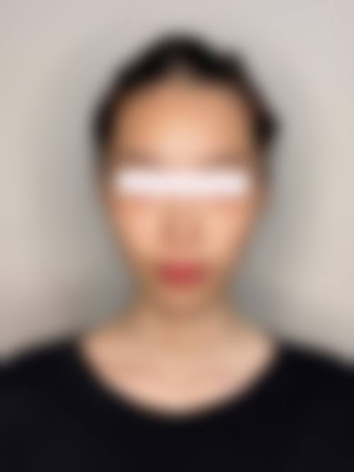 太原大美于心整形医院口碑好不好