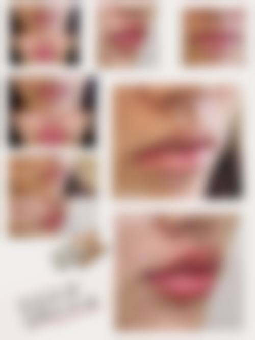 驻马店美林苑医疗整形抖音团购活动有哪些，价格表