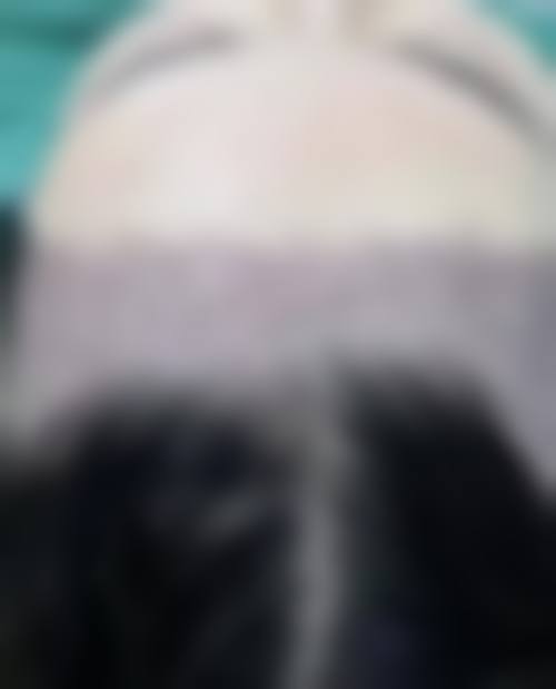 蒋学医生简介中的项目优势