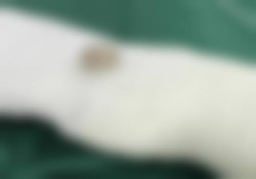 毛波医生简介：口碑如何