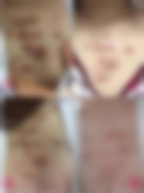 黄晓琴医生简介之做手术价格