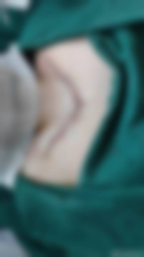 海宁优嘉整形医院项目特色