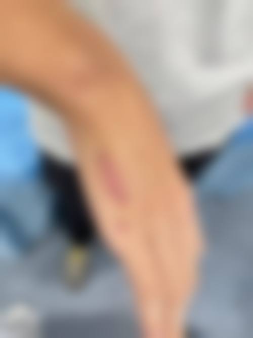 大同美神整形美容诊所怎么样?可靠吗?