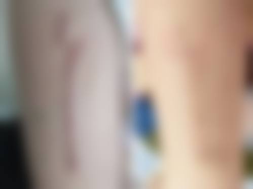 大同美神整形美容诊所怎么样?怎么挂号,地址在哪儿?