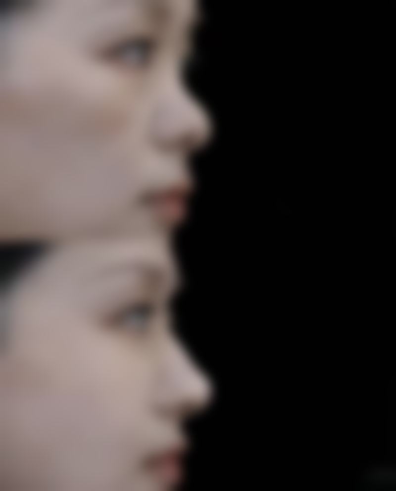 韩国osang神经外科医院价格表——收费合理透明