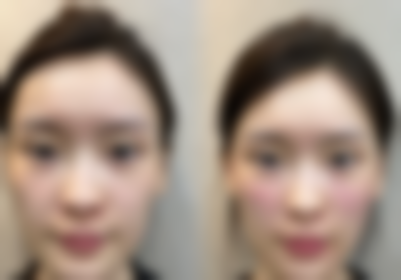 南宁艾美莱整形医院价格表