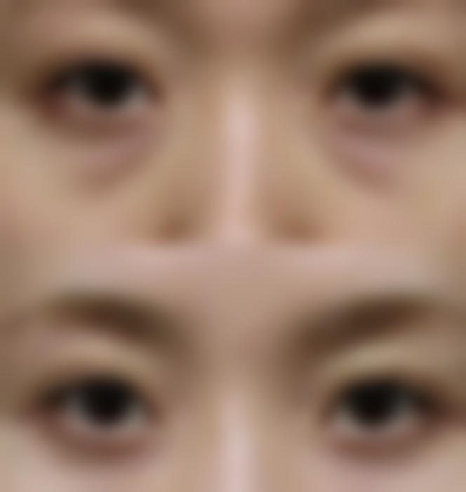 韩国dressps整形外科口碑好不好