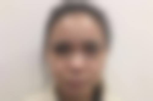 刘静红医生简介顾客实例情况