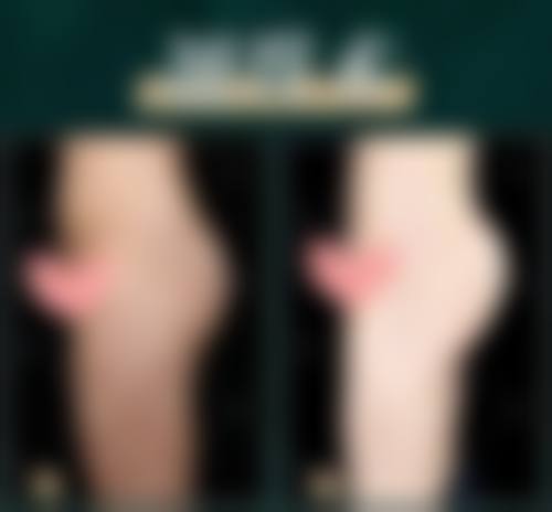 余文林医生简介做手术价格