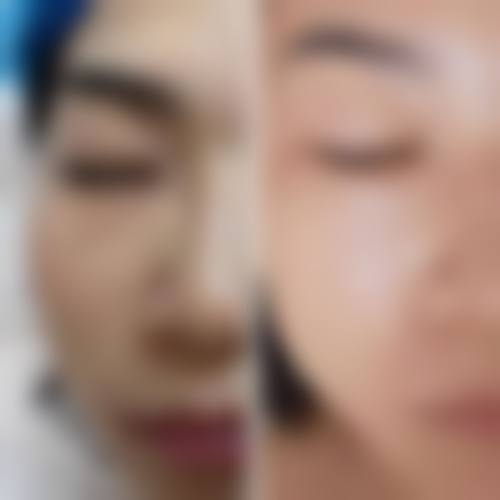 佛山顺德新龄美塑整形医院价格表