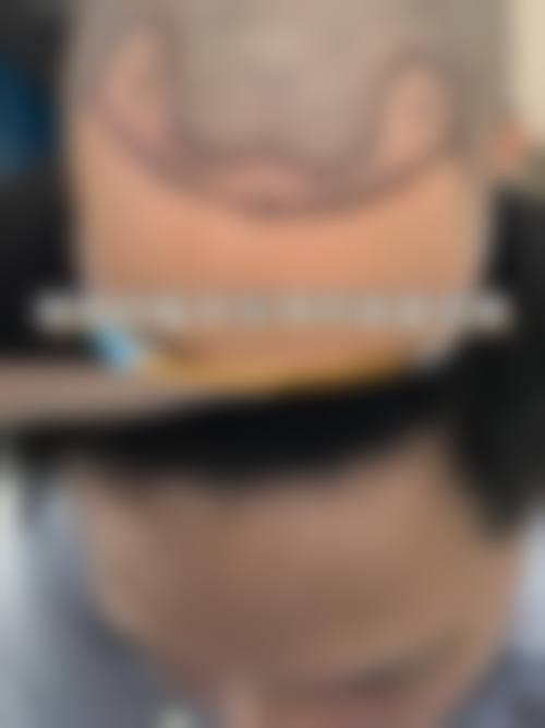 厦门特莱美整形医院怎么样之真实口碑评价