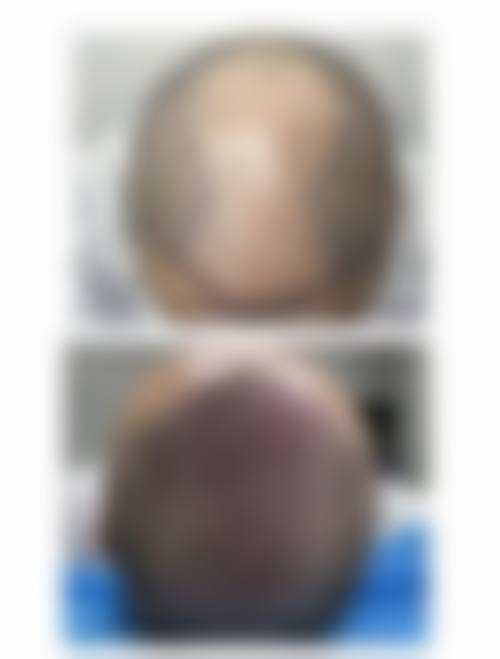 绵阳碧莲盛植发医疗美容诊所可靠吗