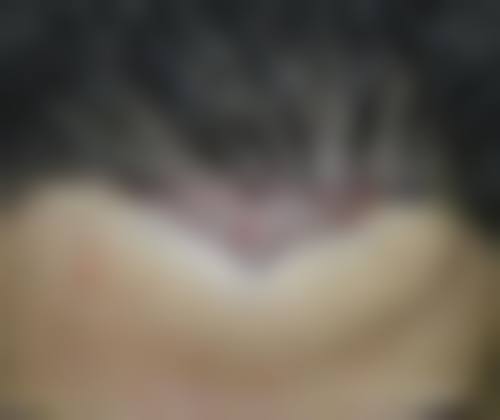 绵阳碧莲盛植发医疗美容诊所评价