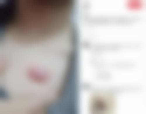 惠州市惠阳区人民医院烧伤整形科基本信息