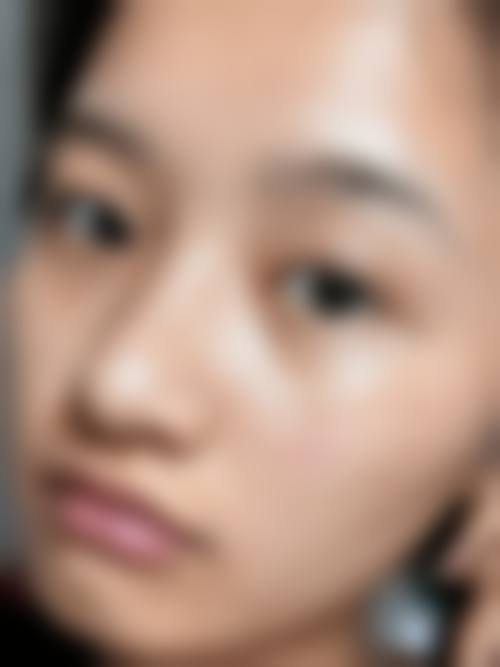 惠州市惠阳区人民医院烧伤整形科口碑评价