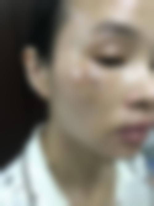 海口市人民医院皮肤美容科价格表