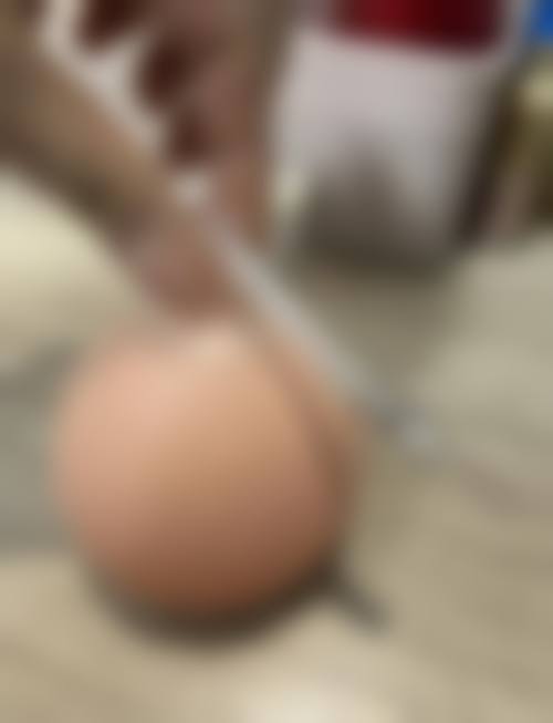 梅梁医生简介：做手术价格