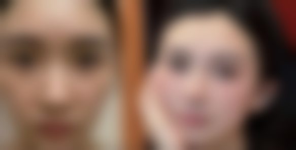 沈阳泺美迪莎医疗美容诊所更擅长什么手术