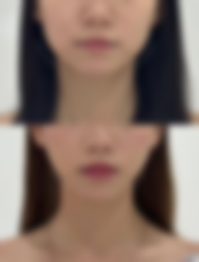 沈阳泺美迪莎医疗美容诊所评价