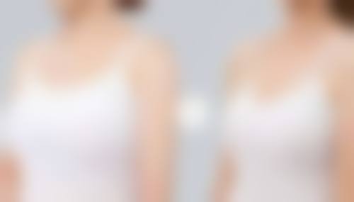 合肥亚典医疗美容口碑好不好