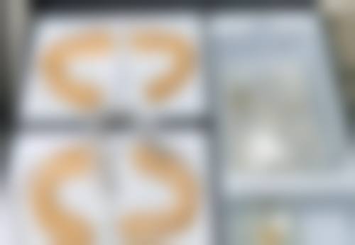 北京新生植发医院口碑好不好？附真实患者口碑评价