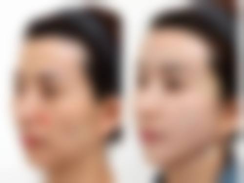 崔圭镇医生简介项目优势