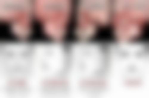 北京新生植发医院价格表