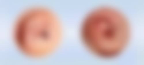 南昌艺生植发医院怎么样之口碑评价