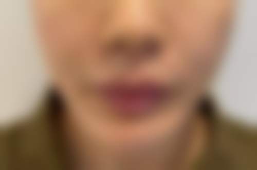 深圳常安医疗美容医院项目特色