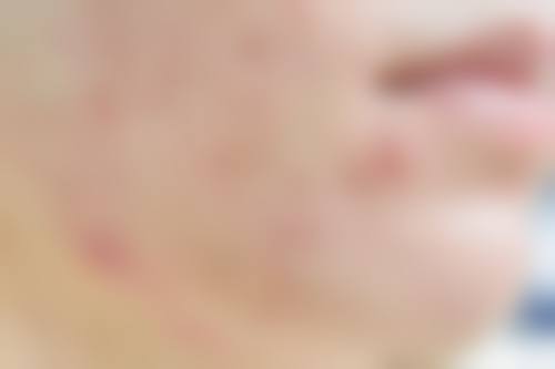 于红敏医生简介做手术价格