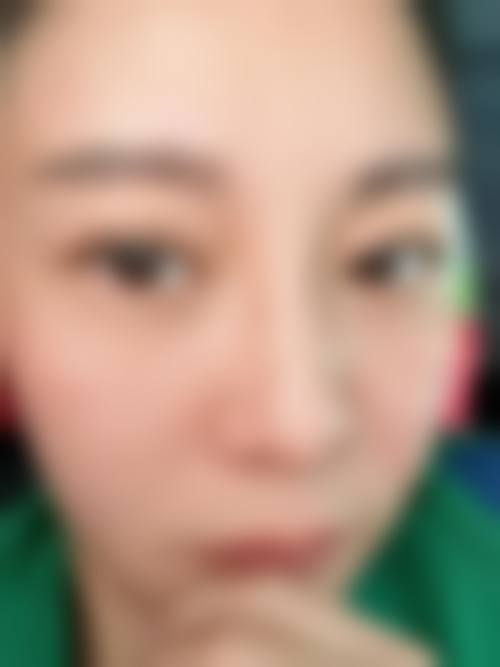 广州韩琇整形医院价格表：不同项目收费差异