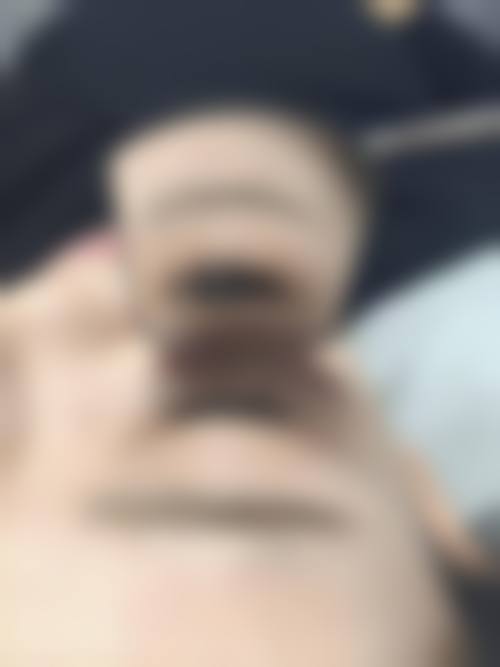 河南商丘昕瑶整形医院价格表