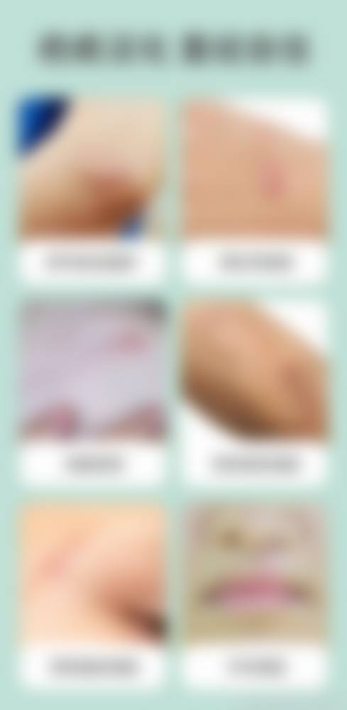 沈余明医生简介做手术价格