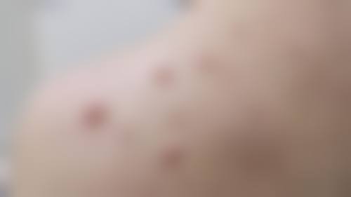 宁波星范医疗整形美容怎么样，资质如何？