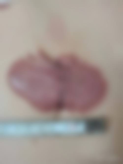 曹长源医生简介之做手术价格