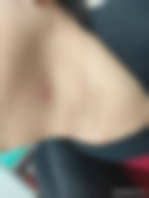 赵云庆医生顾客实例图片